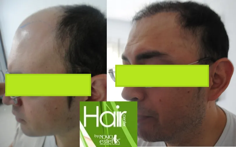 Hair Center by Nova Estetik