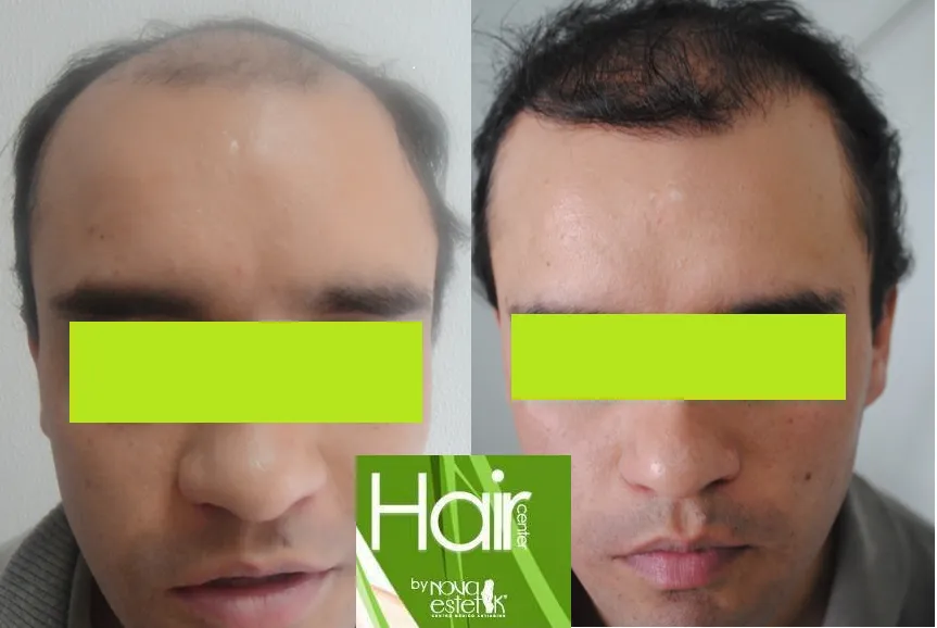 Hair Center by Nova Estetik