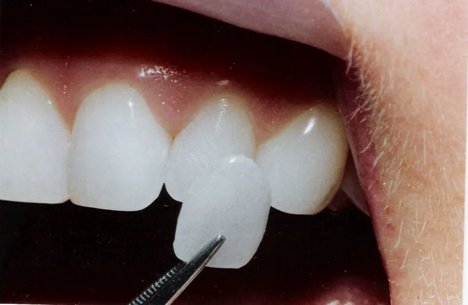 Dental ARTS