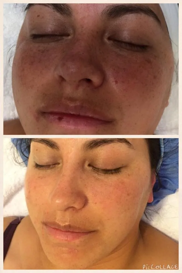 SuKra Cosmetología y Estética Facial
