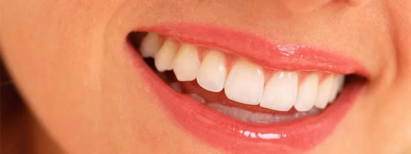 Zirconia Corporacion Dental