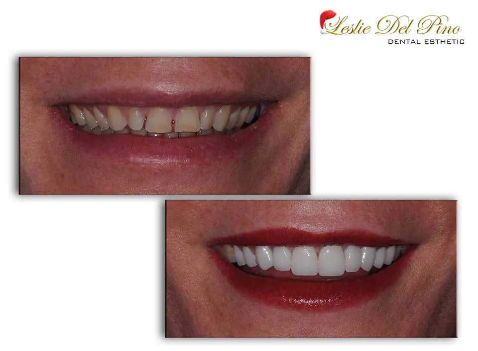 LESLIE DEL PINO DENTAL ESTHETIC